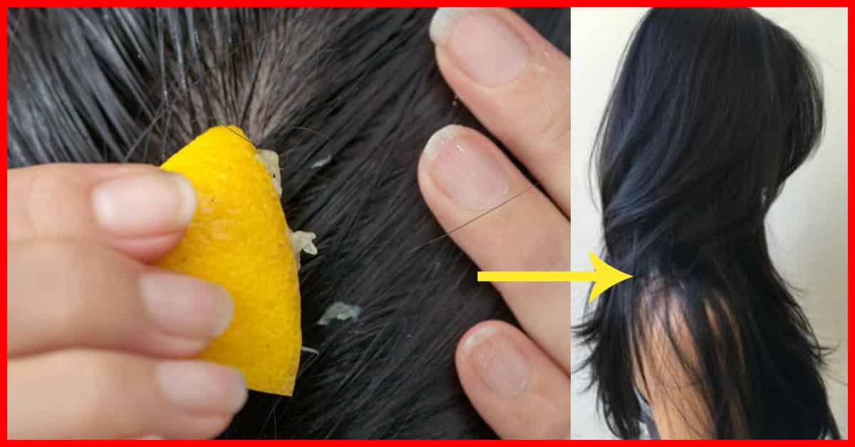Is lemon good for hair